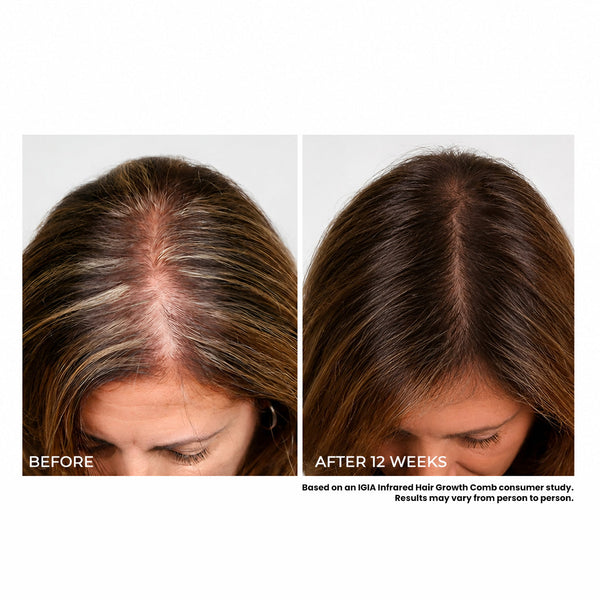 Aragan Secret & Igia Hair Care Set – Argan Oil Leave-In Treatment with Laser & LED Hair Therapy Comb