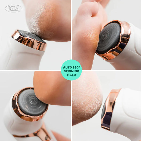 IGIA Callus Remover + Aragan Secret Nail Fungus Repair Oil - 10ml