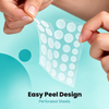 Igia Acne Pimple Patch – Targeted Blemish Patches for Day & Night Use