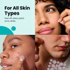 Igia Acne Pimple Patch – Targeted Blemish Patches for Day & Night Use