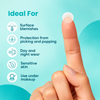 Igia Acne Pimple Patch – Targeted Blemish Patches for Day & Night Use