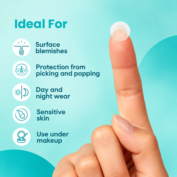 Igia Acne Pimple Patch – Targeted Blemish Patches for Day & Night Use