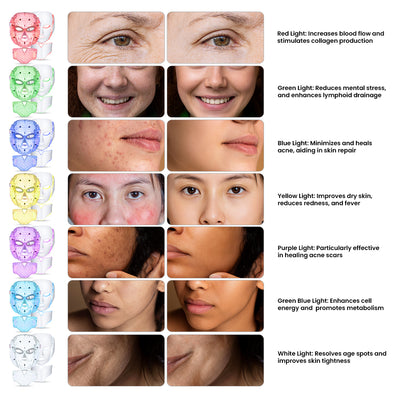 Igia LED Facial Mask - Skin Rejuvenation