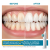 Igia Complete Oral Care Set – High-Pressure Water Flosser & Rechargeable Sonic Plaque Remover