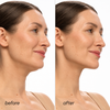 Igia Perfect V Lifting Premium Plus Mask – Hydrogel Neck & Jawline Firming Mask 5 Pack