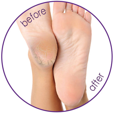 Silky Sox Spa Gel Pedicure Set