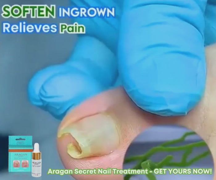 Aragan Secret - Aragan Callus Removing Gel -   A foot  peeling gel with Moroccan Aragan oil that transforms cracked heels and  unsightly calluses. Keeping your feet clean, fresh and soft