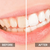 Allura Charcoal Teeth Whitening Powder