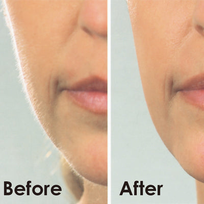 Igia Dermaplaner Hair Remover - Homemark